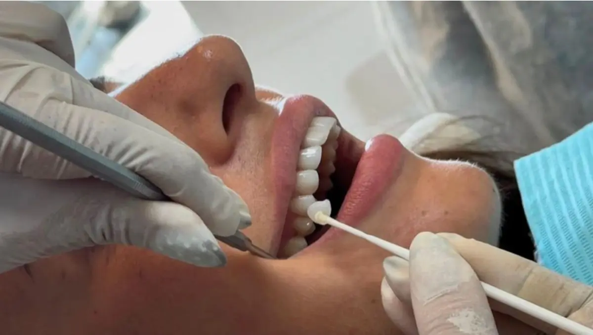 Salah satu perawatan gigi di Dental Aesthetic Clinic. (Dental Aesthetic Clinic)