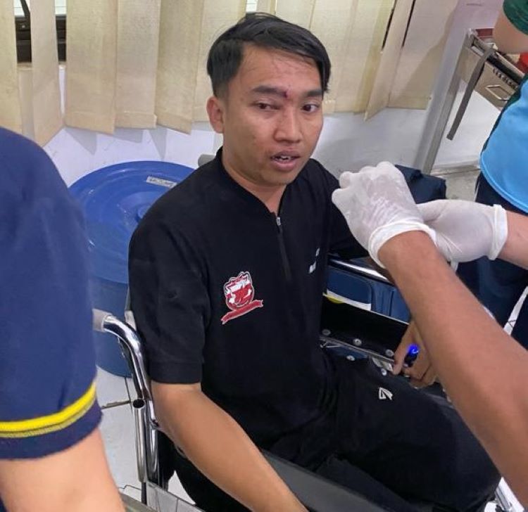 Wajah Ferdiansyah masih bengep - Image