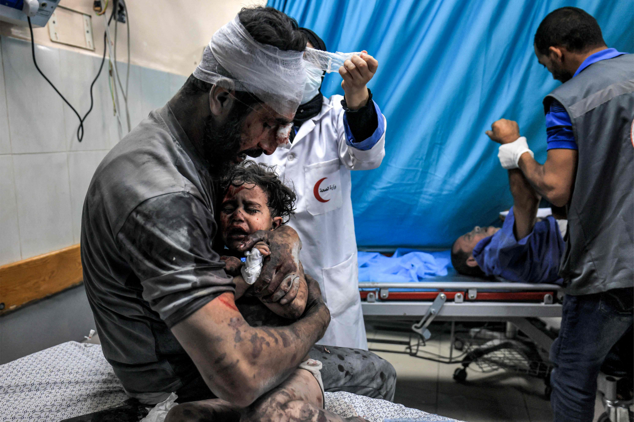 Seorang pria yang terluka menggendong seorang anak yang terluka, keduanya selamat dari pengeboman Israel./AFP-Yonhap - Image