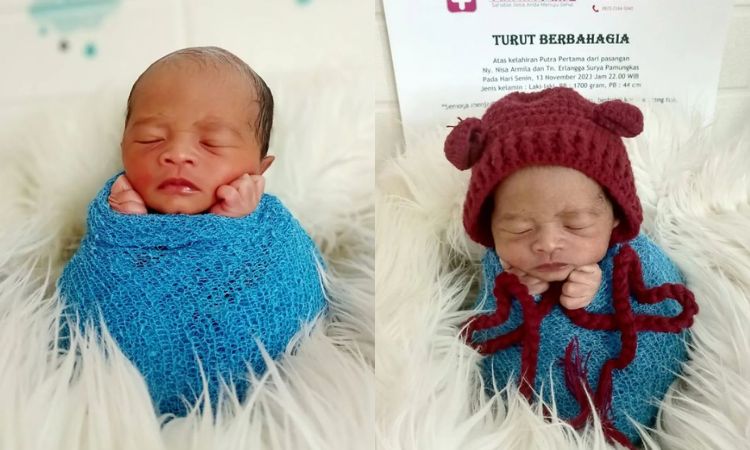 Bayi di Tasikmalaya korban malpraktik klinik ALIFA.Instagram @nadiaanastasyasilvera - Image