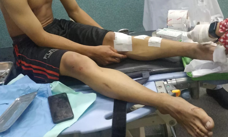 Kondisi korban usai dikeroyok. (Radar Sidoarjo) - Image