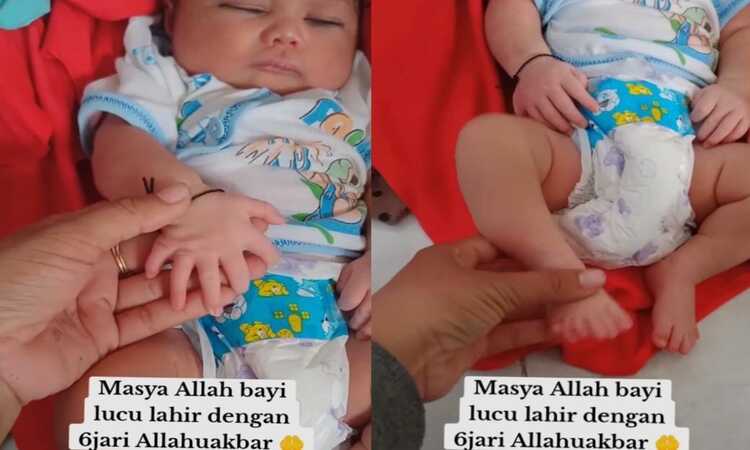 Bayi berjenis kelamin perempuan di Madura memiliki 6 jari di kedua tangan dan kakinya/ sumber: akun TikTok @intannovita005 - Image