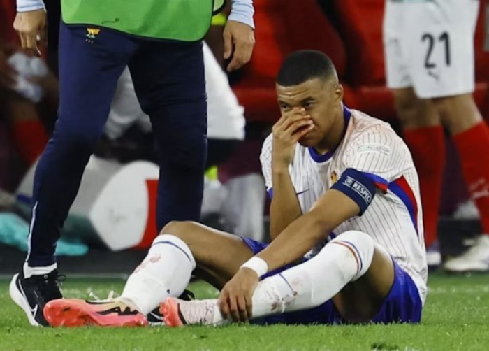 SIAPKAN PELINDUNG: Kylian Mbappe mengalami cedera parah di Euro 2024 (FIFA) - Image