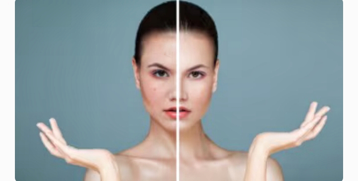 Bahan perawatan kulit yang dapat membantu pori-pori terbuka. (Health Shots) - Image