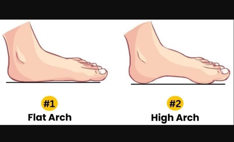 Ilustrasi bentuk lengkungan kaki. (Jagran Josh) - Image