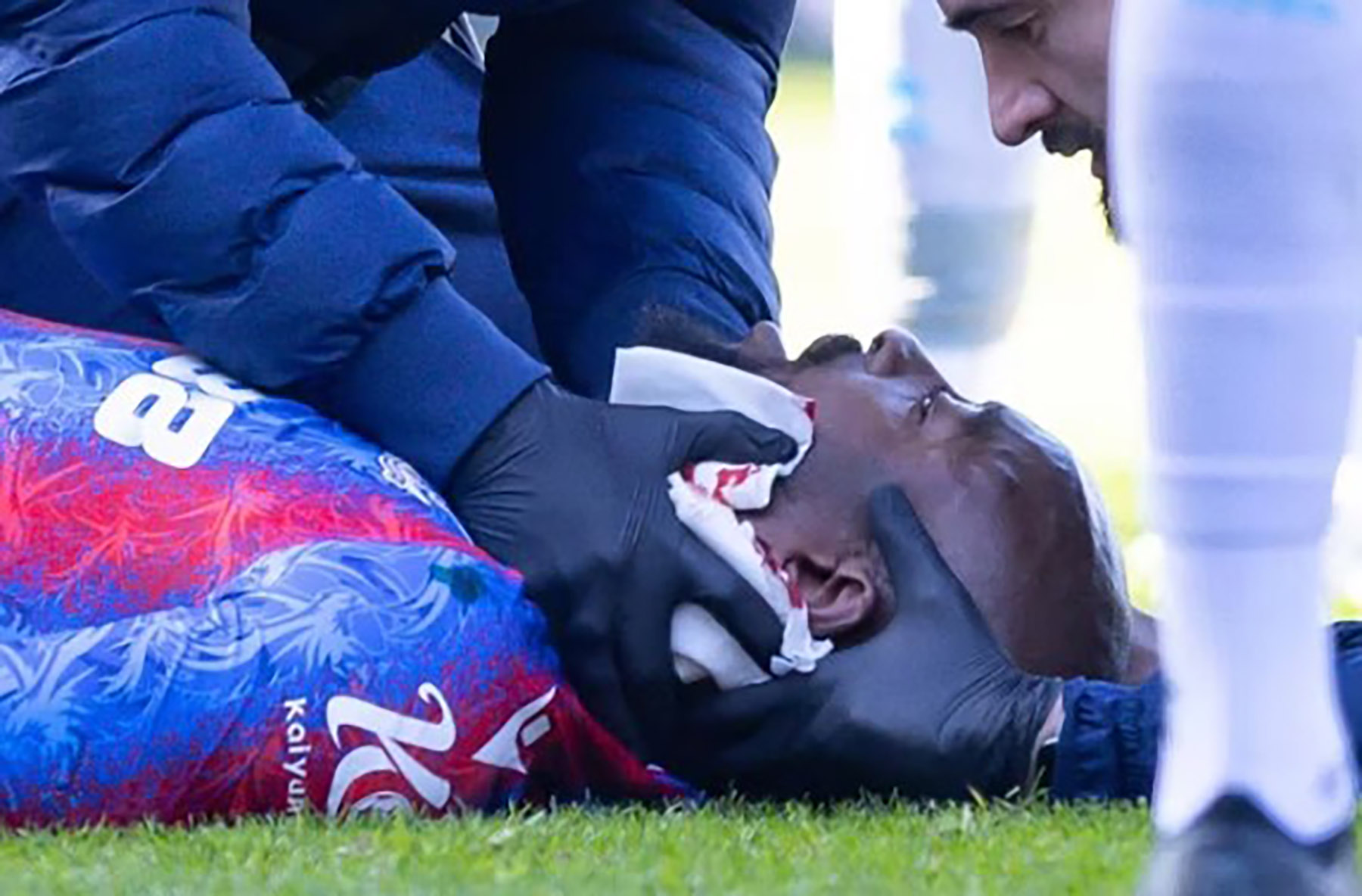 Jean-Philippe Mateta mengalami cedera serius akibat tekel kiper Millwall, Liam Roberts. (Dok. EPL) - Image
