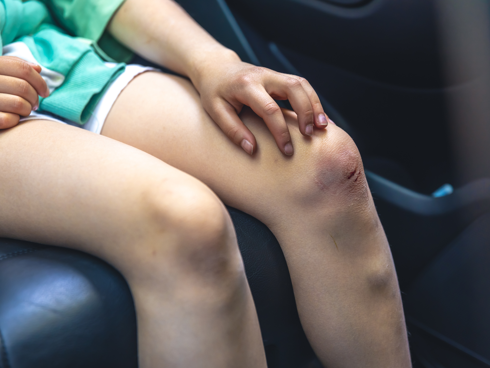 Ilustrasi seseorang yang mengalami memar (Dok. Freepik) - Image