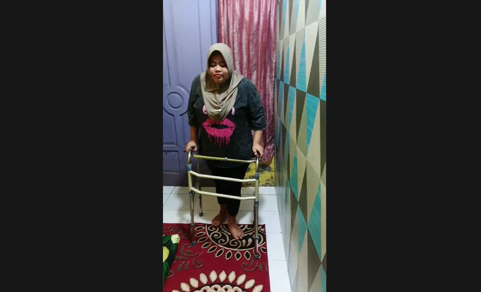Kondisi Nopi Karyadi ,29, terkini, saat belajar berjalan dengan menggunakan alat bantu agar tak terjatuh. (Istimewa).