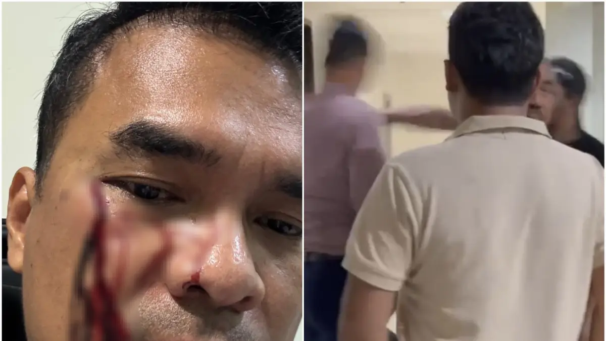 Kolase detik-detik dan pasca pemukulan Wakil Ketua Umum Partai Solidaritas Indonesia (PSI), Ronald A Sinaga. (Istimewa) - Image