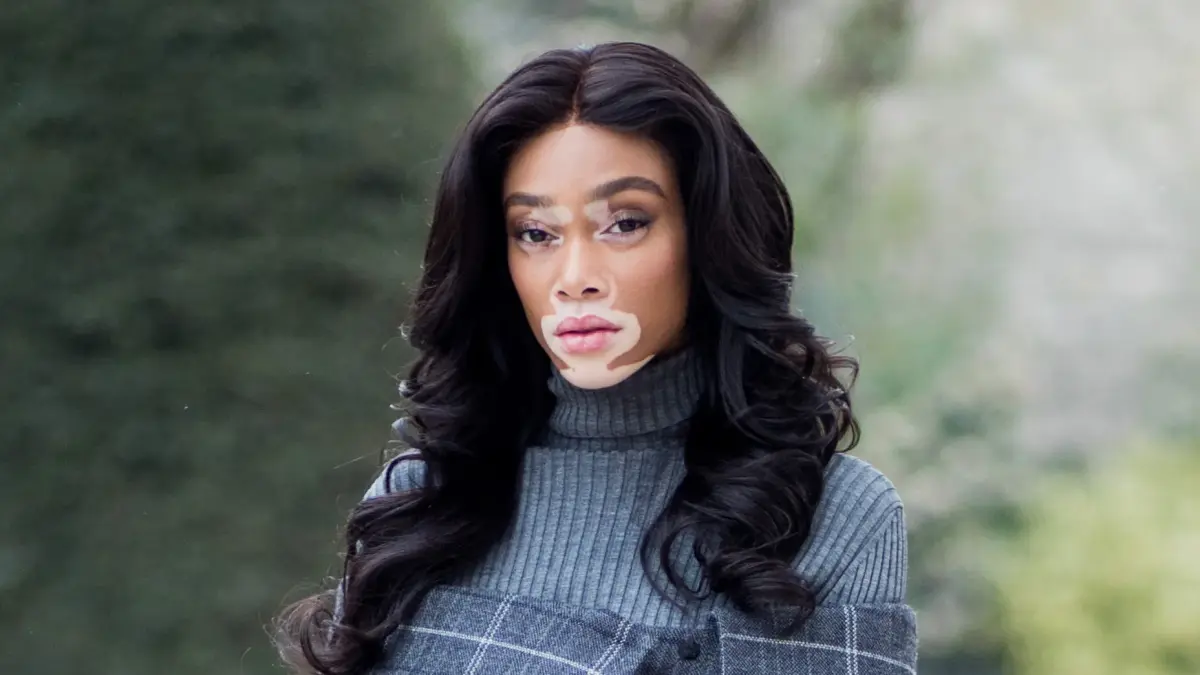 Model Winnie Harlow. (Self Magazine) - Image