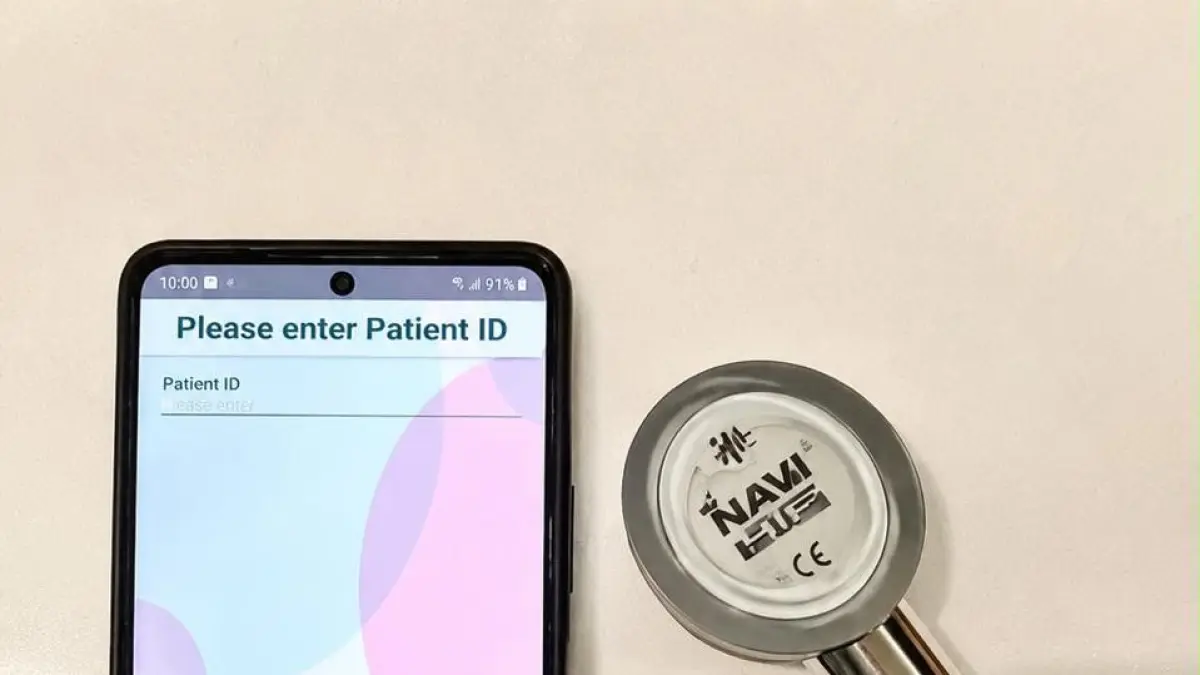 Prototipe Novel Auscultation Device of Artificial Intelligence for Heart Failure (NAVI-HF), alat auskultasi berbasis AI yang dapat dihubungkan langsung ke smartphone (Istimewa) - Image