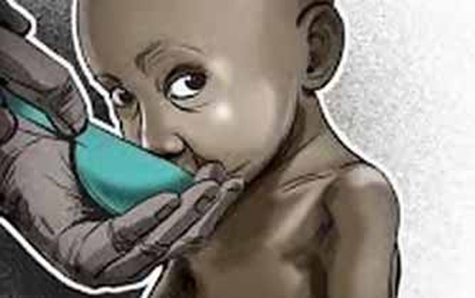 Ilustrasi bocah penderita gizi buruk - Image