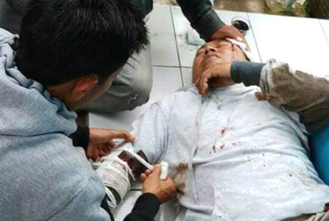 Nyawa Ustad Prawoto tidak tertolong setelah dianiaya oleh pelaku dengan menggunakan linggis. - Image