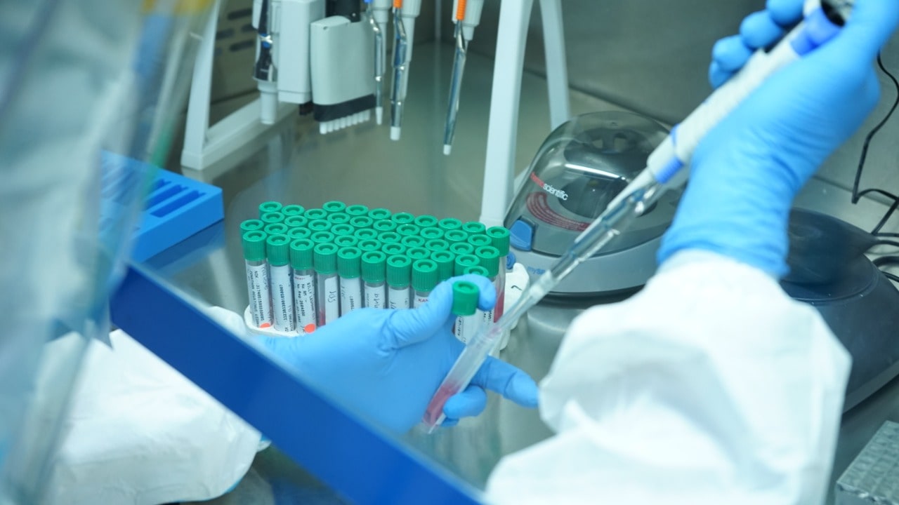 Kegiatan para laboran swtiap hari menguji spesimen tes Covid-19 lewat PCR/dokumentasi tim laboratorium - Image