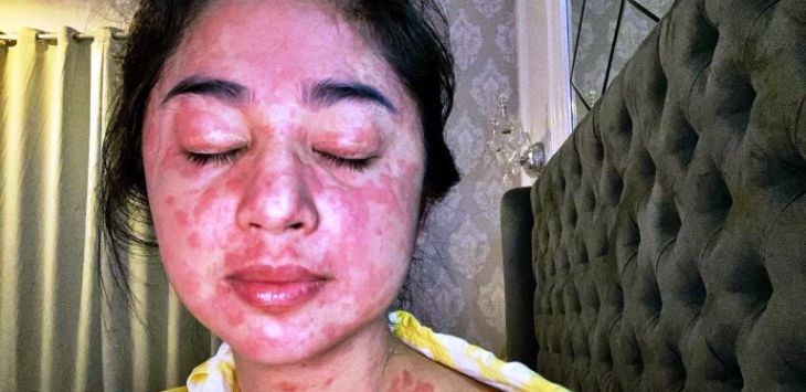 Kondisi Dewi Perssik karena Covid-19. Foto : Instagram/@dewiperssikreal - Image