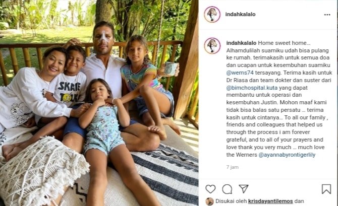 Suami Indah Kalalo sudah pulang ke rumah pasca operasi akibat kecelakaan yang dialaminya beberapa waktu lalu./Instagram Indah Kalalo - Image