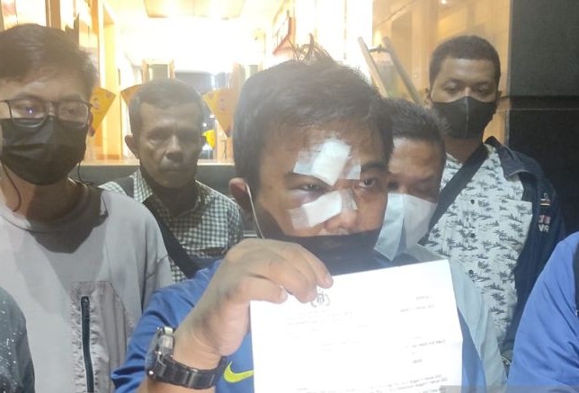 Ketua Umum DPP Komite Nasional Pemuda Indonesia (KNPI) Haris Pertama melaporkan peristiwa pengeroyokan yang dialaminya. Antara - Image