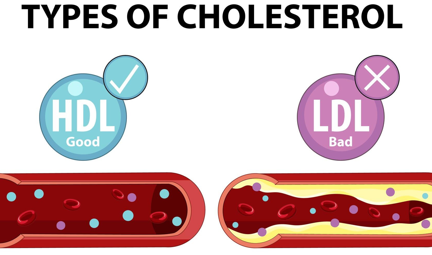 Ilustrasi kolesterol