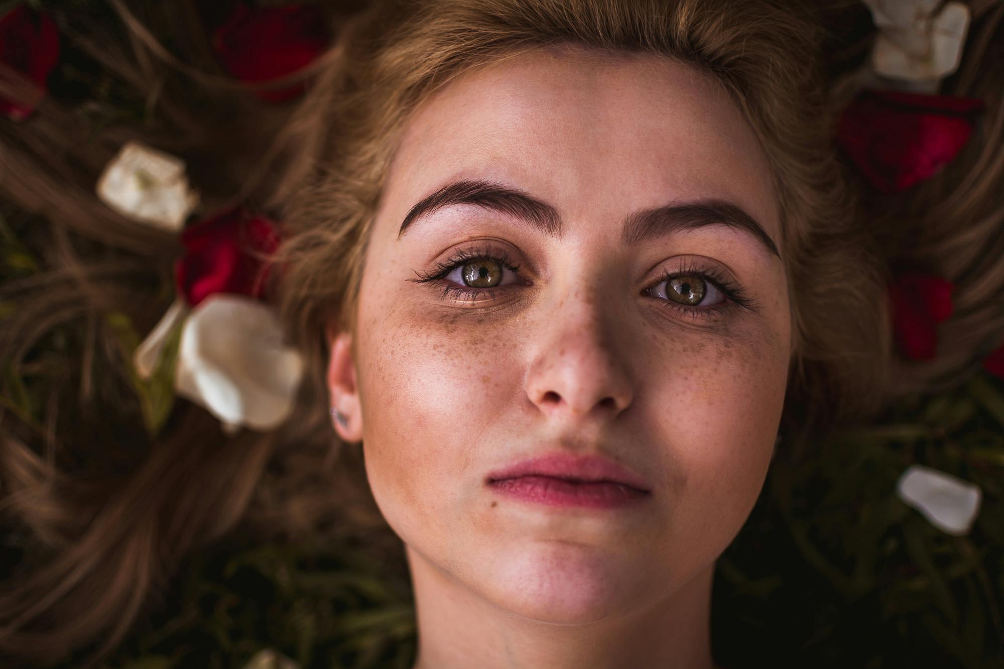 Ilustrasi orang yang memiliki freckles. (Pexels)