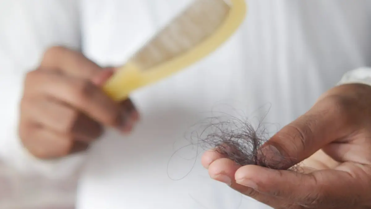 Ilustrasi rambut rontok (Pexels)