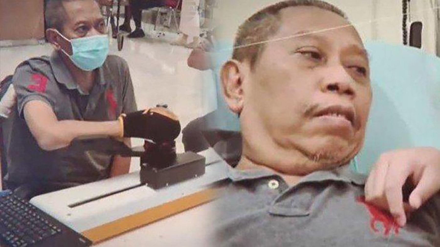 Tukul Arwana menjalani terapi stroke.