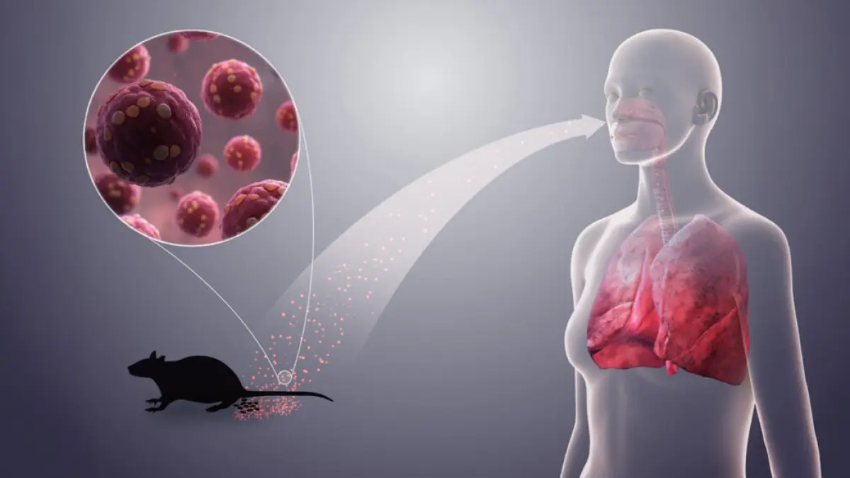 Ilustrasi transmisi Hantavirus. (blogs.insanmedika.co.id via IPB University)
