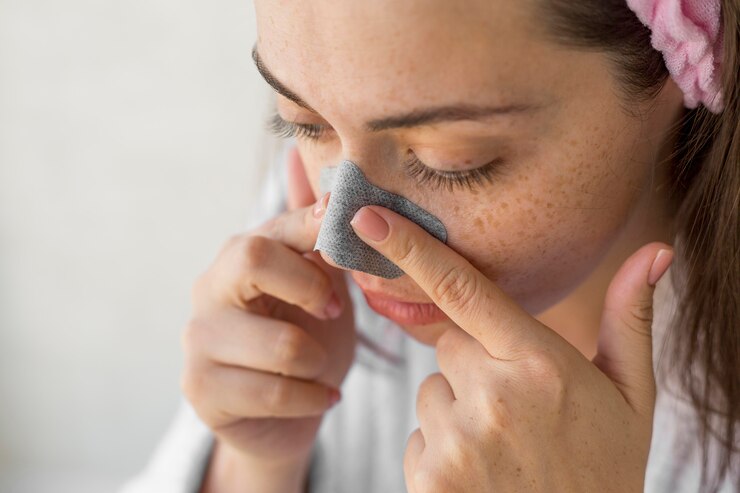 Ilustrasi komedo di hidung